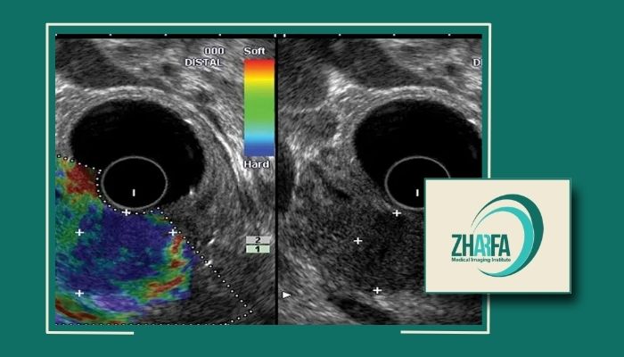 الاستوگرافی پستان در تهران توسط پزشک با تجربه الاستوگرافی پستان در تهران توسط پزشک با تجربه