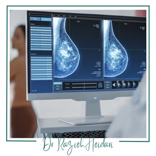 آمادگی لازم قبل از تصویربرداری پستان