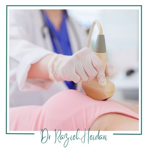 نحوه انجام سونوگرافی نحوه انجام سونوگرافی