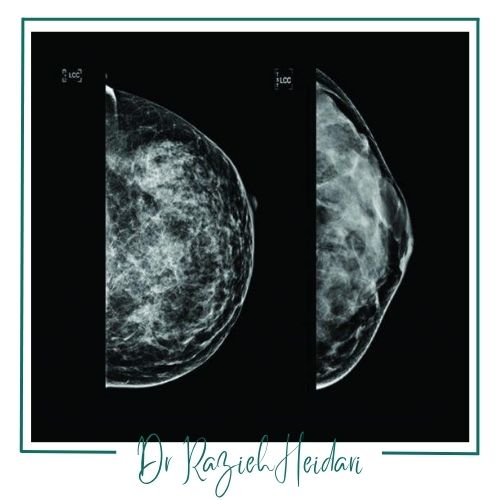 نتایج تصویربرداری نتایج تصویربرداری