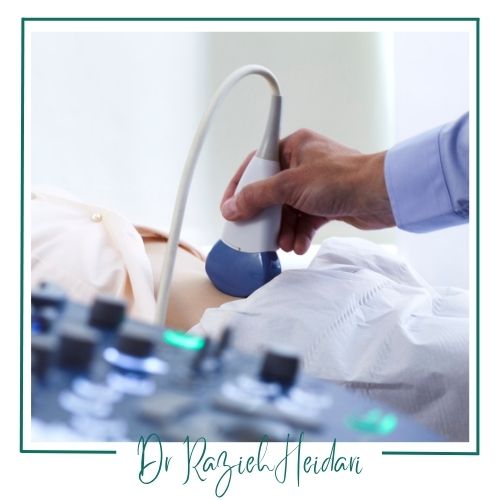 هزینه هزینه