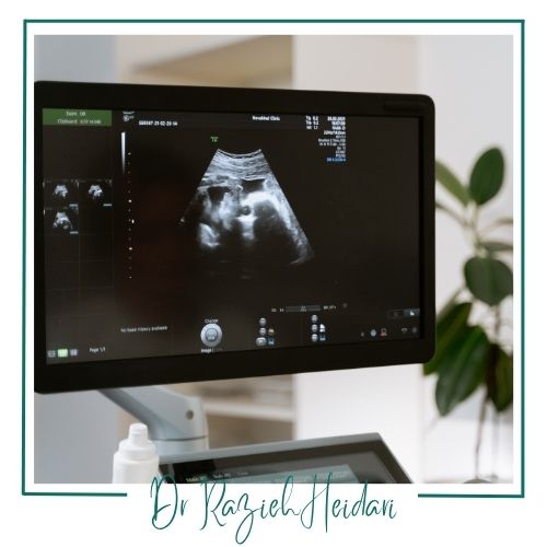 معایب سونوگرافی معایب سونوگرافی