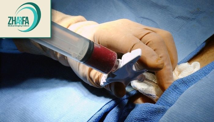 انواع بیوپسی بر اساس محل انواع بیوپسی بر اساس محل