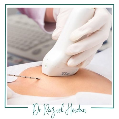 مراحل انجام برداشت نمونه مراحل انجام برداشت نمونه