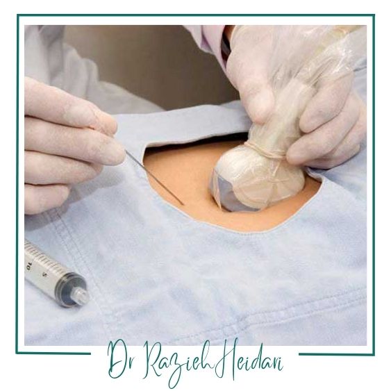 اهمیت بیوپسی در تشخیص بیماریها اهمیت بیوپسی در تشخیص بیماریها