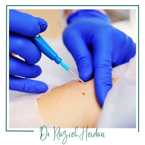 عوارض بیوپسی عوارض بیوپسی