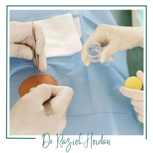 هزینه گرفتن نمونه هزینه گرفتن نمونه