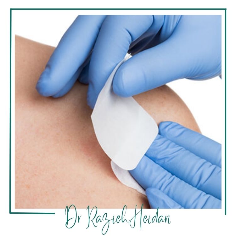 مراقبتهای پس از برداشت نمونه مراقبتهای پس از برداشت نمونه