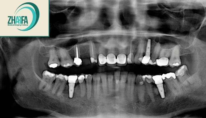 کاربردهای او پی جی کاربردهای او پی جی