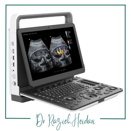 هزینه تست سونوگرافی رنگی هزینه تست سونوگرافی رنگی