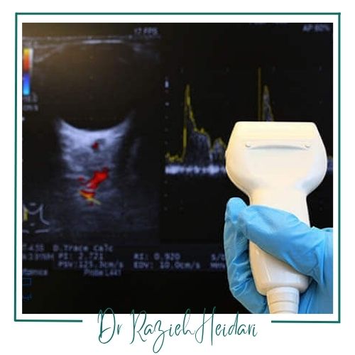 آمادگی لازم قبل از تست آمادگی لازم قبل از تست