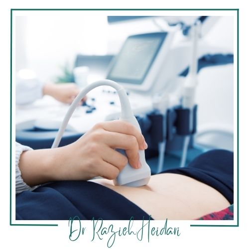 نحوه انجام سونو رنگی نحوه انجام سونو رنگی