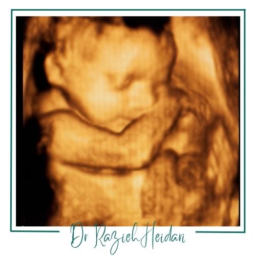 انواع تکنیکهای تصویربرداری رنگی انواع تکنیکهای تصویربرداری رنگی