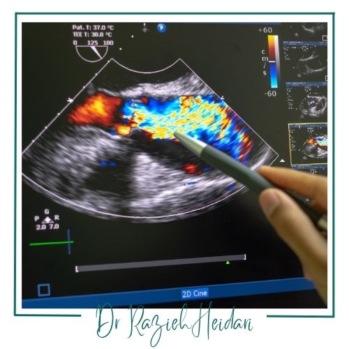 کاربردهای سونوگرافی رنگی کاربردهای سونوگرافی رنگی