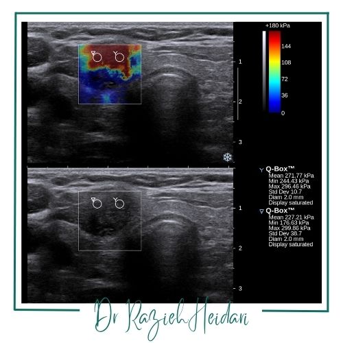 انواع اصلی الاستوگرافی انواع اصلی الاستوگرافی