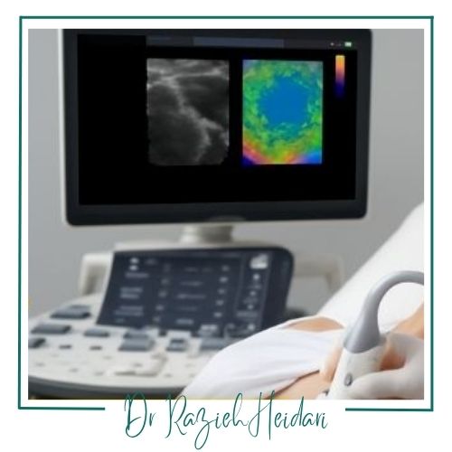 هزینه الاستوگرافی پستان هزینه الاستوگرافی پستان