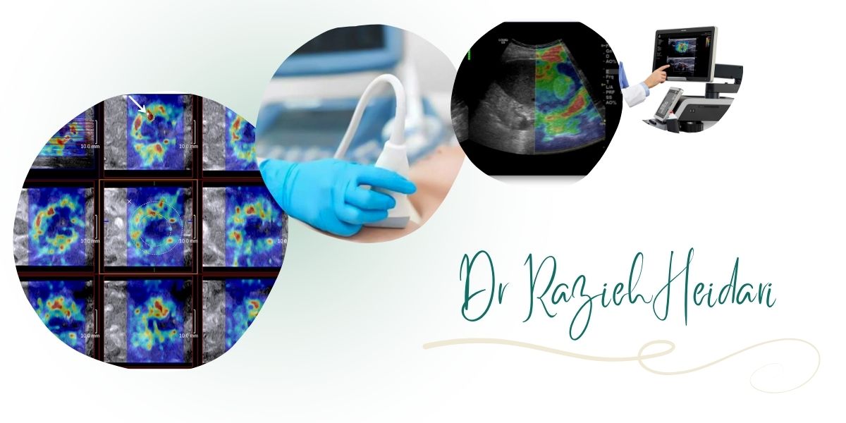 مرکز دکتر حیدری بهترین مرکز الاستوگرافی پستان در تهران مرکز دکتر حیدری بهترین مرکز الاستوگرافی پستان در تهران