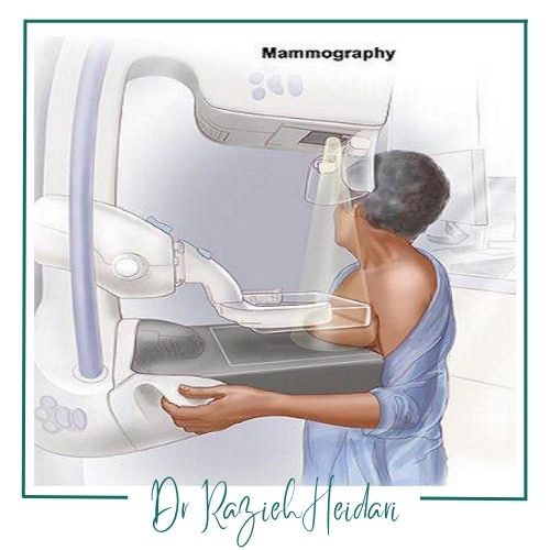 نحوه انجام تصویربرداری پستان نحوه انجام تصویربرداری پستان
