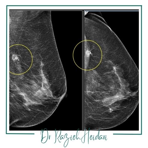 محدودیتهای مامو محدودیتهای مامو