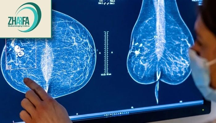 تفاوت ماموگرافی با سونوگرافی پستان تفاوت ماموگرافی با سونوگرافی پستان