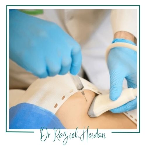 دلایل انجام نمونهبرداری پستان دلایل انجام نمونهبرداری پستان