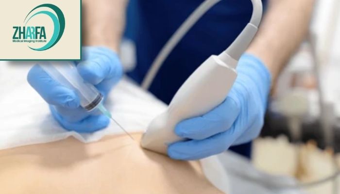 مراقبتهای بعد از FNA پستان مراقبتهای بعد از FNA پستان