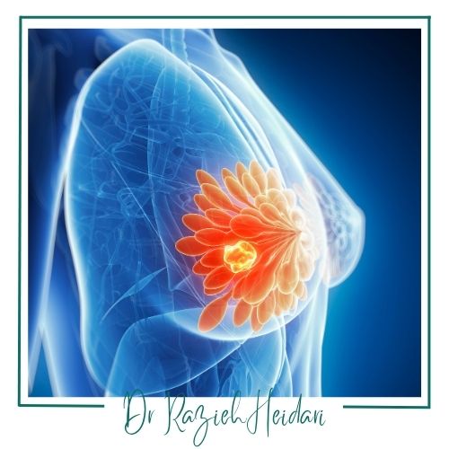 آمادگی های قبل از بیوپسی برست آمادگی های قبل از بیوپسی برست