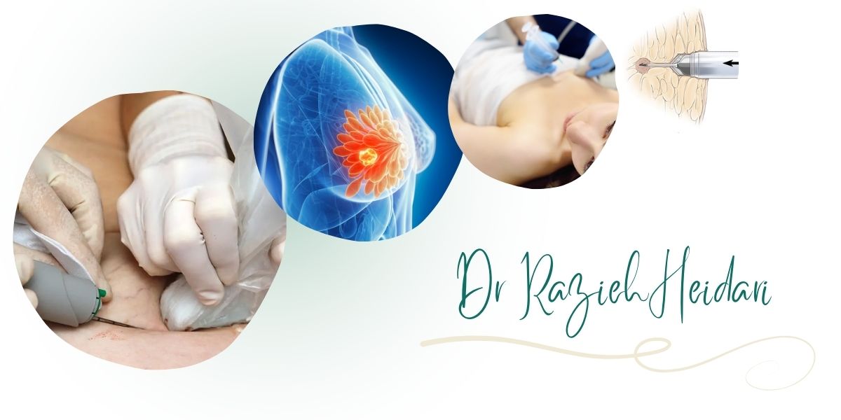 دکتر حیدری بهترین مرکز نمونه برداری سینه در پیروزی و شرق تهران دکتر حیدری بهترین مرکز نمونه برداری سینه در پیروزی و شرق تهران