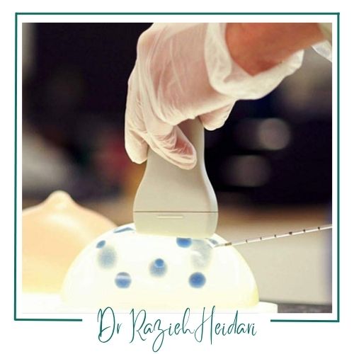 مراحل نمونه برداری با وکیوم از پستان مراحل نمونه برداری با وکیوم از پستان