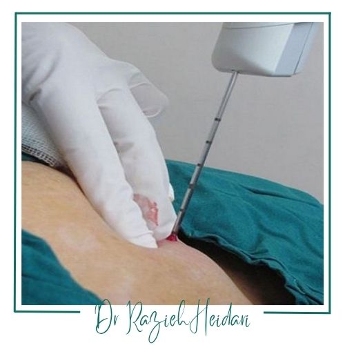 مراقبتهای پس از نمونه برداری مراقبتهای پس از نمونه برداری