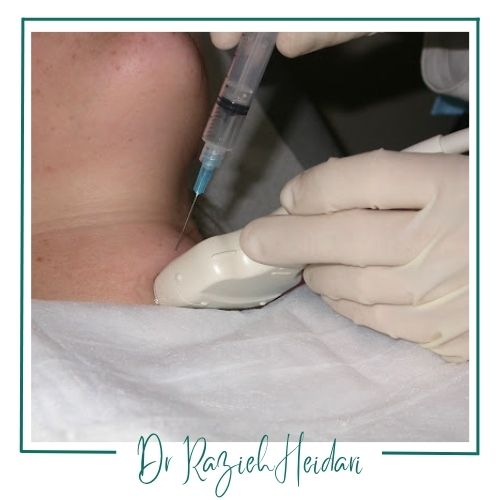 نمونهبرداری تیروئید نمونهبرداری تیروئید