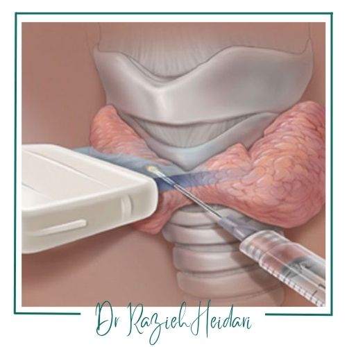 مراقبتهای بعد از برداشت نمونه مراقبتهای بعد از برداشت نمونه