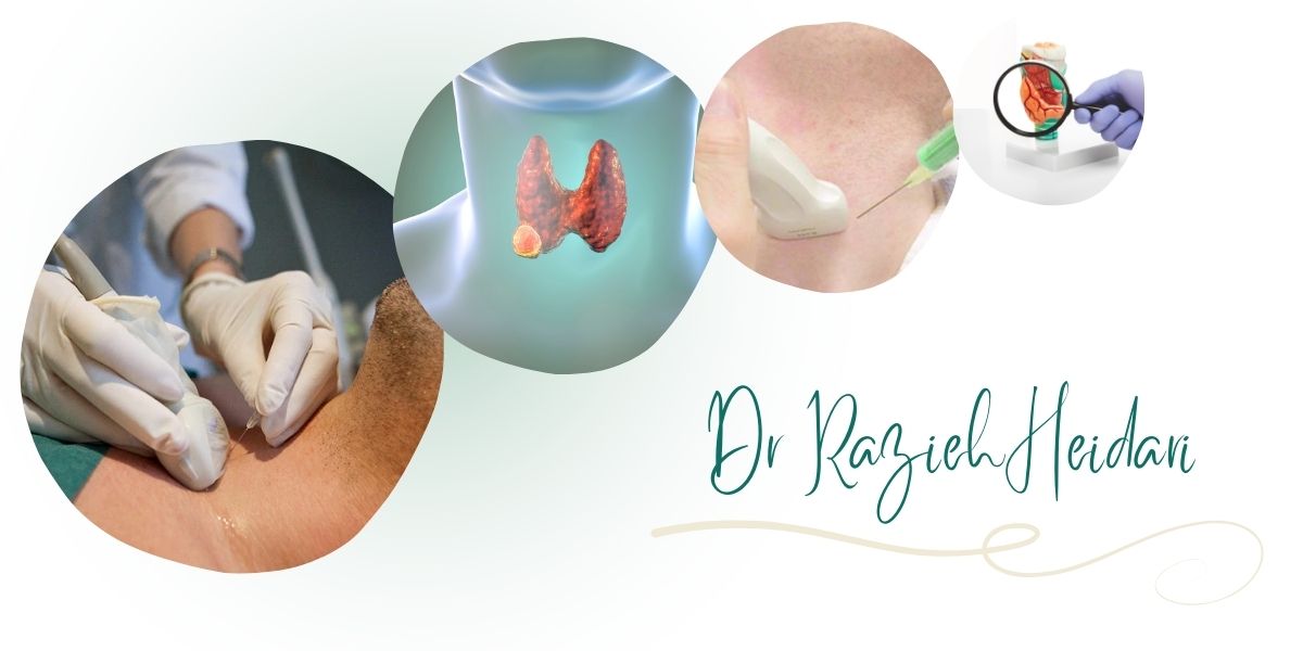 دکتر حیدری بهترین مرکز نمونه برداری تیروئید در پیروزی و شرق تهران دکتر حیدری بهترین مرکز نمونه برداری تیروئید در پیروزی و شرق تهران