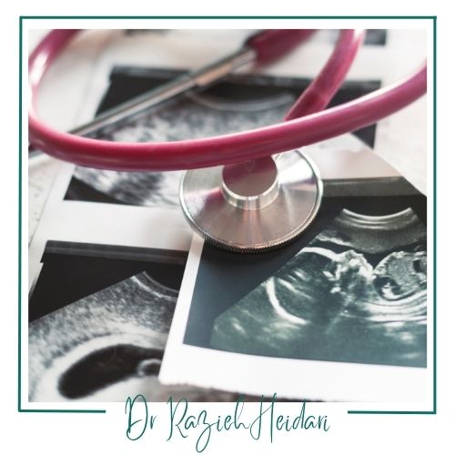 هزینه عکس برداری فراصوت در دوران بارداری