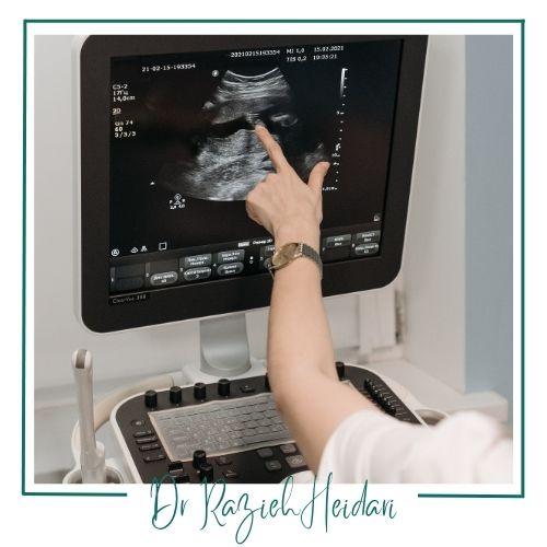 دلایل انجام اولتراسوند آنومالی