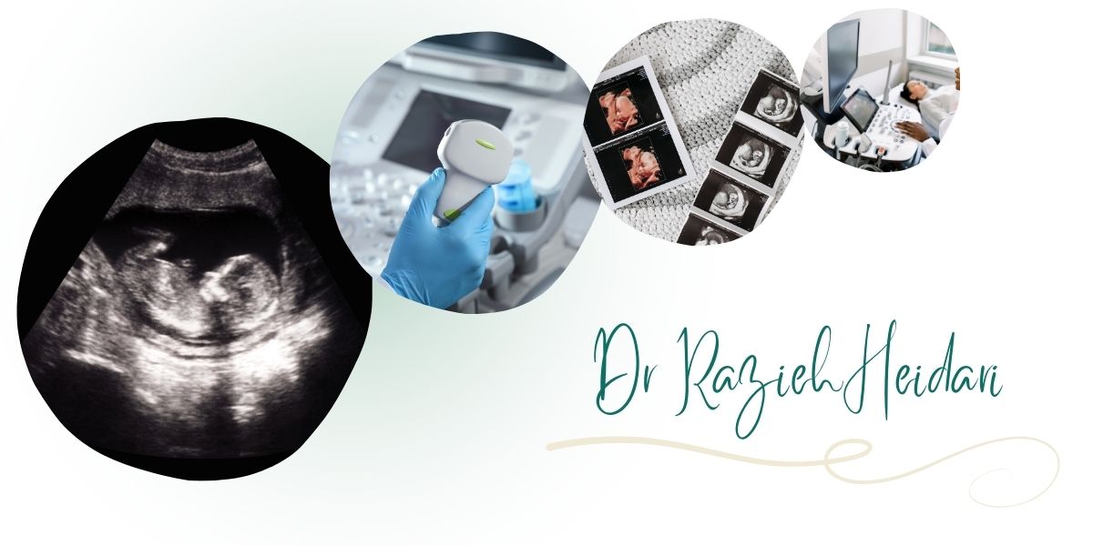 دکتر حیدری بهترین مرکز سونوگرافی آنومالی در پیروزی و شرق تهران