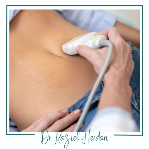 نحوه غربالگری سلامت جنین با سونوگرافی