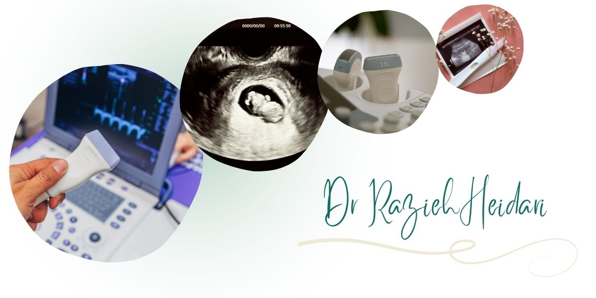 مرکز دکتر حیدری بهترین مرکز سونوگرافی NT در تهران