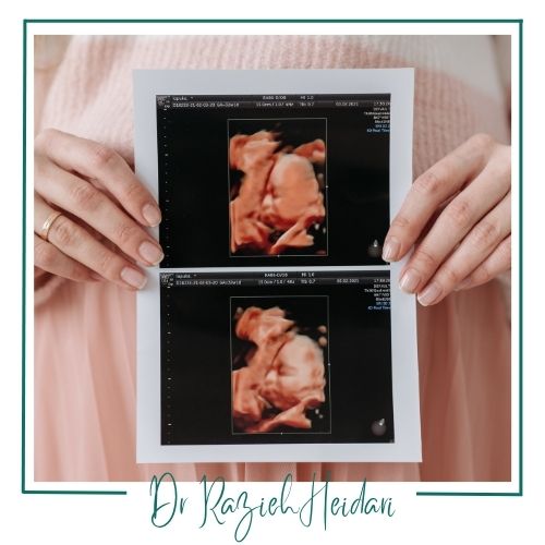 سونوگرافی سه‌بعدی در دوران بارداری