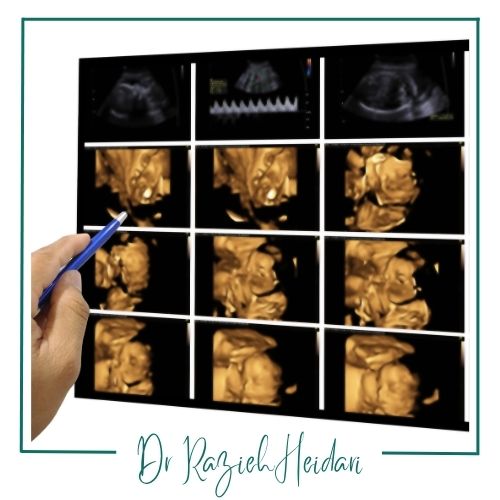 مزایای سونو سه‌بعدی