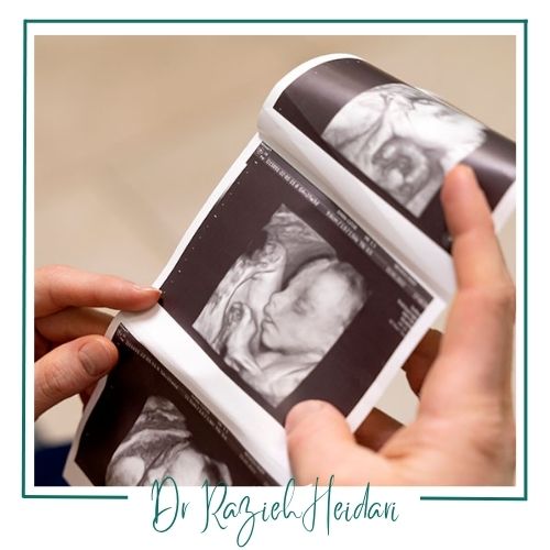 محدودیت‌های سونوگرافی 3بعدی