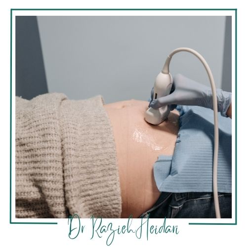 نحوه انجام سونو 3 بعدی