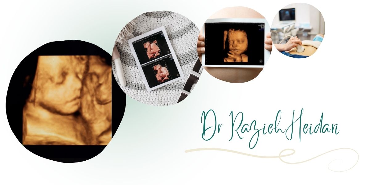 دکتر حیدری بهترین مرکز سونوگرافی سه‌ بعدی در پیروزی و شرق تهران