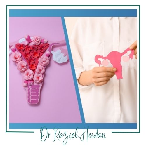 مراحل انجام سونو هیستروگرافی