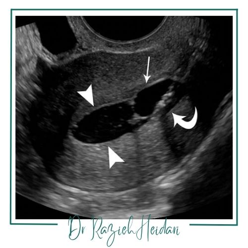 مزایای این درمان