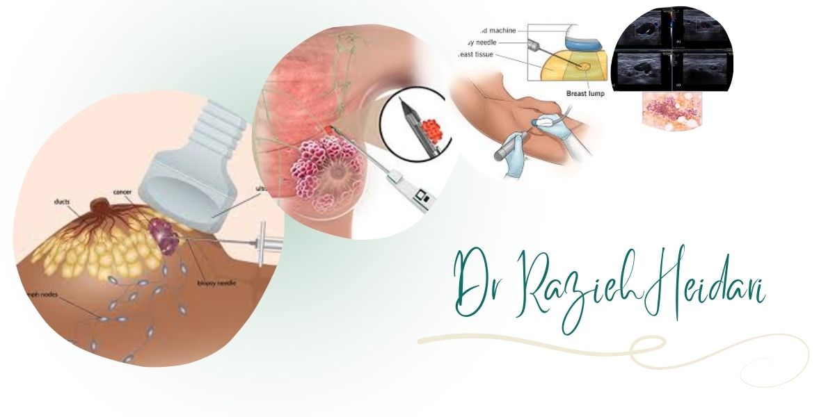 چرا دکتر حیدری بهترین متخصص FNA پستان در شرق تهران است؟ چرا دکتر حیدری بهترین متخصص FNA پستان در شرق تهران است؟