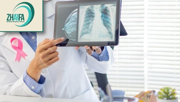 عوامل مؤثر بر میزان درد ماموگرافی