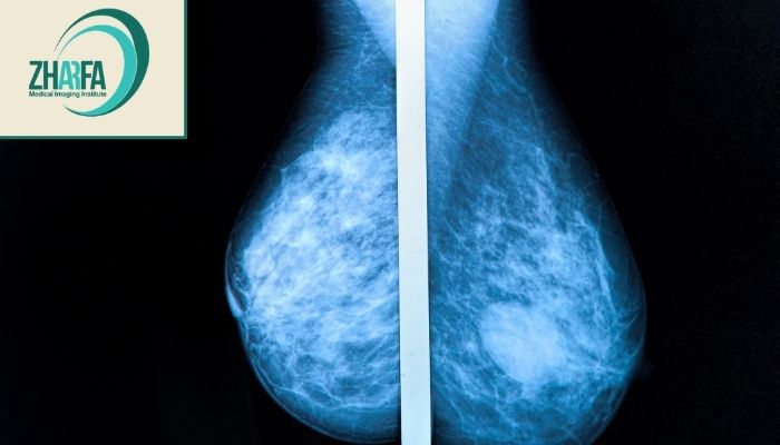 نکات ایمنی و میزان اشعه