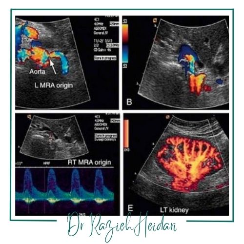انواع سونوگرافی داپلر رنگی انواع سونوگرافی داپلر رنگی