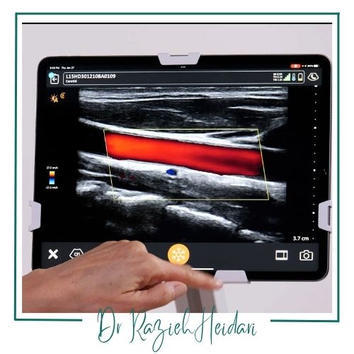سونوگرافی داپلر عروق سونوگرافی داپلر عروق